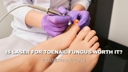 Is Laser for Toenail Fungus Worth It