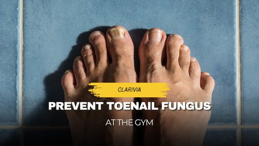 Prevent Toenail Fungus at the Gym