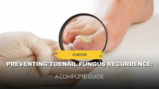 Preventing Toenail Fungus Recurrence