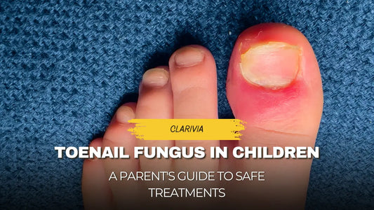 Toenail Fungus in Children