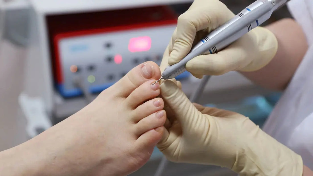 Toenail Fungus in Diabetics: The U.S. Clinician-Vetted Guide to Prevent Serious Foot Complications