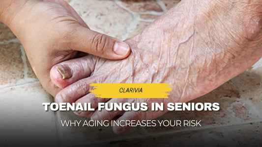Toenail Fungus and Aging